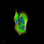 IRAK-M Antibody in Immunocytochemistry (ICC/IF)