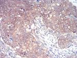 IRAK-M Antibody in Immunohistochemistry (Paraffin) (IHC (P))