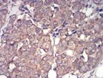 IRAK-M Antibody in Immunohistochemistry (Paraffin) (IHC (P))