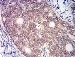 MYST2 Antibody in Immunohistochemistry (Paraffin) (IHC (P))