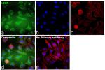 LDLR Antibody in Immunocytochemistry (ICC/IF)