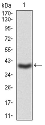 LDLR Antibody in Western Blot (WB)