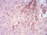 MMP14 Antibody in Immunohistochemistry (Paraffin) (IHC (P))