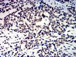 hnRNP M Antibody in Immunohistochemistry (Paraffin) (IHC (P))