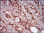 NBS1 Antibody in Immunohistochemistry (Paraffin) (IHC (P))