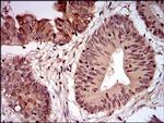 NBS1 Antibody in Immunohistochemistry (Paraffin) (IHC (P))