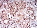 NBS1 Antibody in Immunohistochemistry (Paraffin) (IHC (P))