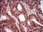 NBS1 Antibody in Immunohistochemistry (Paraffin) (IHC (P))