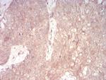 NOX4 Antibody in Immunohistochemistry (Paraffin) (IHC (P))