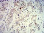 PCK2 Antibody in Immunohistochemistry (Paraffin) (IHC (P))