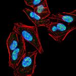 PLCG2 Antibody in Immunocytochemistry (ICC/IF)