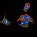 PLCG2 Antibody in Immunocytochemistry (ICC/IF)