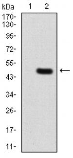 PLCG2 Antibody in Western Blot (WB)