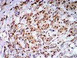 PSMC3 Antibody in Immunohistochemistry (Paraffin) (IHC (P))