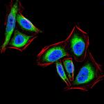 PTP1B Antibody in Immunocytochemistry (ICC/IF)