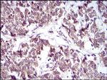 PTP1B Antibody in Immunohistochemistry (Paraffin) (IHC (P))