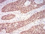 RAN Antibody in Immunohistochemistry (Paraffin) (IHC (P))