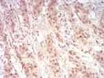 RAN Antibody in Immunohistochemistry (Paraffin) (IHC (P))