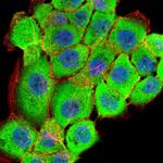 RSK3 Antibody in Immunocytochemistry (ICC/IF)