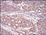 RSK3 Antibody in Immunohistochemistry (Paraffin) (IHC (P))