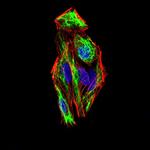 SLUG Antibody in Immunocytochemistry (ICC/IF)