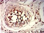 SPA17 Antibody in Immunohistochemistry (Paraffin) (IHC (P))