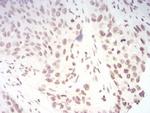 TERT Antibody in Immunohistochemistry (Paraffin) (IHC (P))