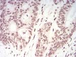 TERT Antibody in Immunohistochemistry (Paraffin) (IHC (P))