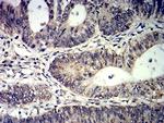 TET2 Antibody in Immunohistochemistry (Paraffin) (IHC (P))