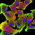 Tyrosine Hydroxylase Antibody in Immunocytochemistry (ICC/IF)