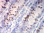 TOP2A Antibody in Immunohistochemistry (Paraffin) (IHC (P))