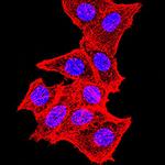 TOP2A Antibody in Immunocytochemistry (ICC/IF)