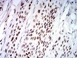 UFD1L Antibody in Immunohistochemistry (Paraffin) (IHC (P))