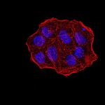 UHRF1 Antibody in Immunocytochemistry (ICC/IF)