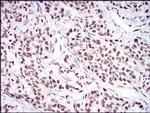 Ku70 Antibody in Immunohistochemistry (Paraffin) (IHC (P))