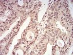 14-3-3 beta Antibody in Immunohistochemistry (Paraffin) (IHC (P))