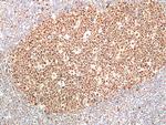 RNASEH2B Antibody in Immunohistochemistry (Paraffin) (IHC (P))