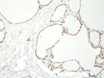 PAX8 Antibody in Immunohistochemistry (Paraffin) (IHC (P))