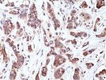 p70 S6 Kinase Antibody in Immunohistochemistry (Paraffin) (IHC (P))