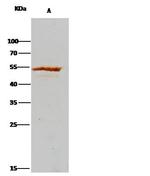 ADSL Antibody in Immunoprecipitation (IP)