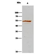 ADSL Antibody in Immunoprecipitation (IP)