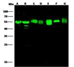 ADSL Antibody in Western Blot (WB)