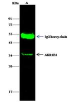 AKR1B1 Antibody in Immunoprecipitation (IP)