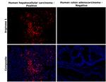 Arginase 1 Antibody in Immunohistochemistry (Paraffin) (IHC (P))