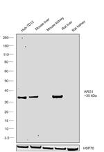 Arginase 1 Antibody in Western Blot (WB)