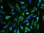 Arginase 1 Antibody in Immunocytochemistry (ICC/IF)