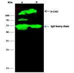 E-cadherin Antibody in Immunoprecipitation (IP)