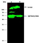 E-cadherin Antibody in Immunoprecipitation (IP)