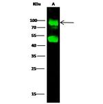 GNS Antibody in Western Blot (WB)