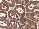 HSP70 Antibody in Immunohistochemistry (Paraffin) (IHC (P))